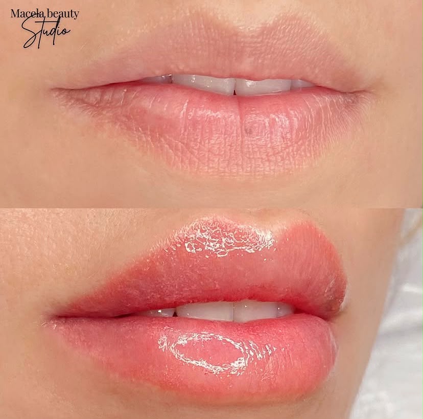 Micropigmentação Labial